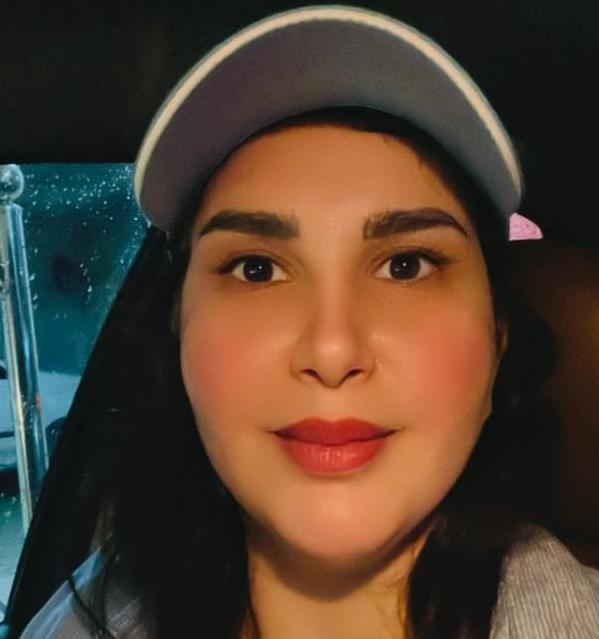 نمونه ابروی کاشته شده بدون جراحی