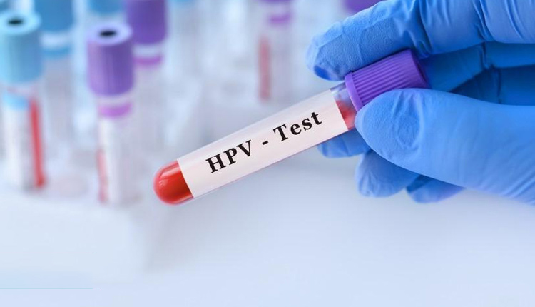 آزمایش HPV منفی