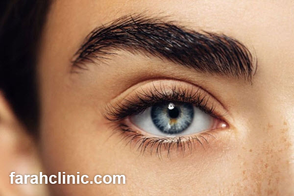 کاشت ابرو بدون جراحی به روش میکرو در تهران | فرح کلینیک