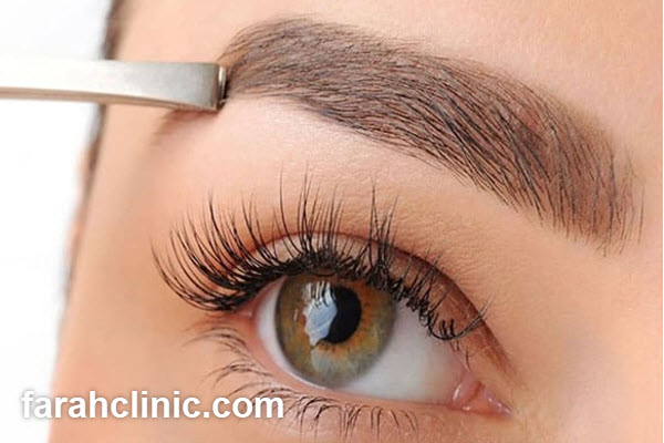 مزایای کاشت ابرو بدون جراحی به روش میکرو | فرح کلینیک