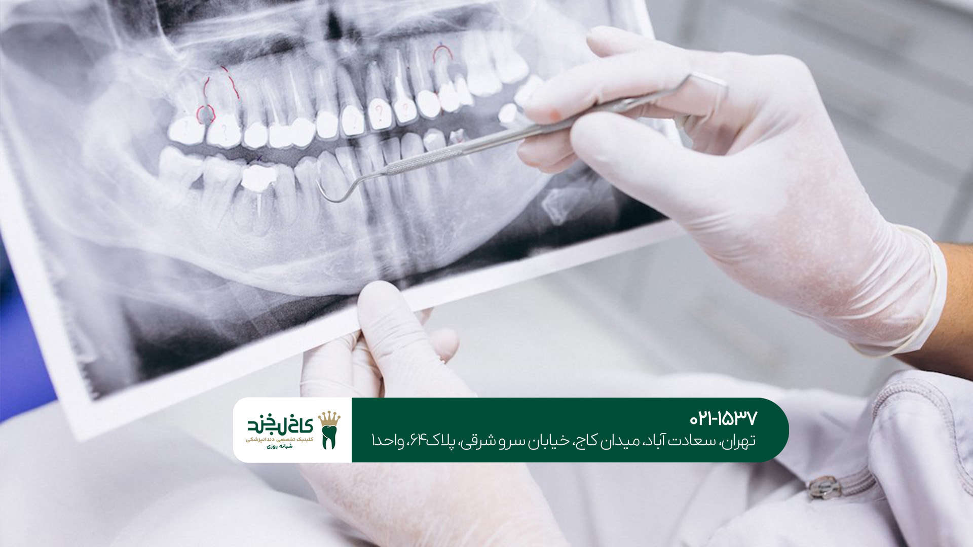 دندانپزشکی در تهران 28 دندانپزشکی