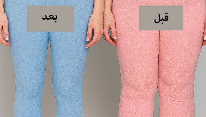 برای لاغر شدن ران پا چه کنیم؟ از رژیم غذایی تا کنترل لیپیدما