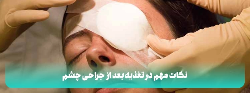 نکات مهم در تغذیه بعد از جراحی چشم