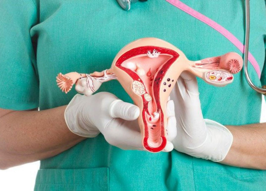 بهترین دکتر برای برداشتن رحم را در کرج