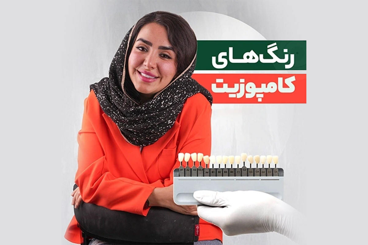 انواع رنگ ونیر کامپوزیت