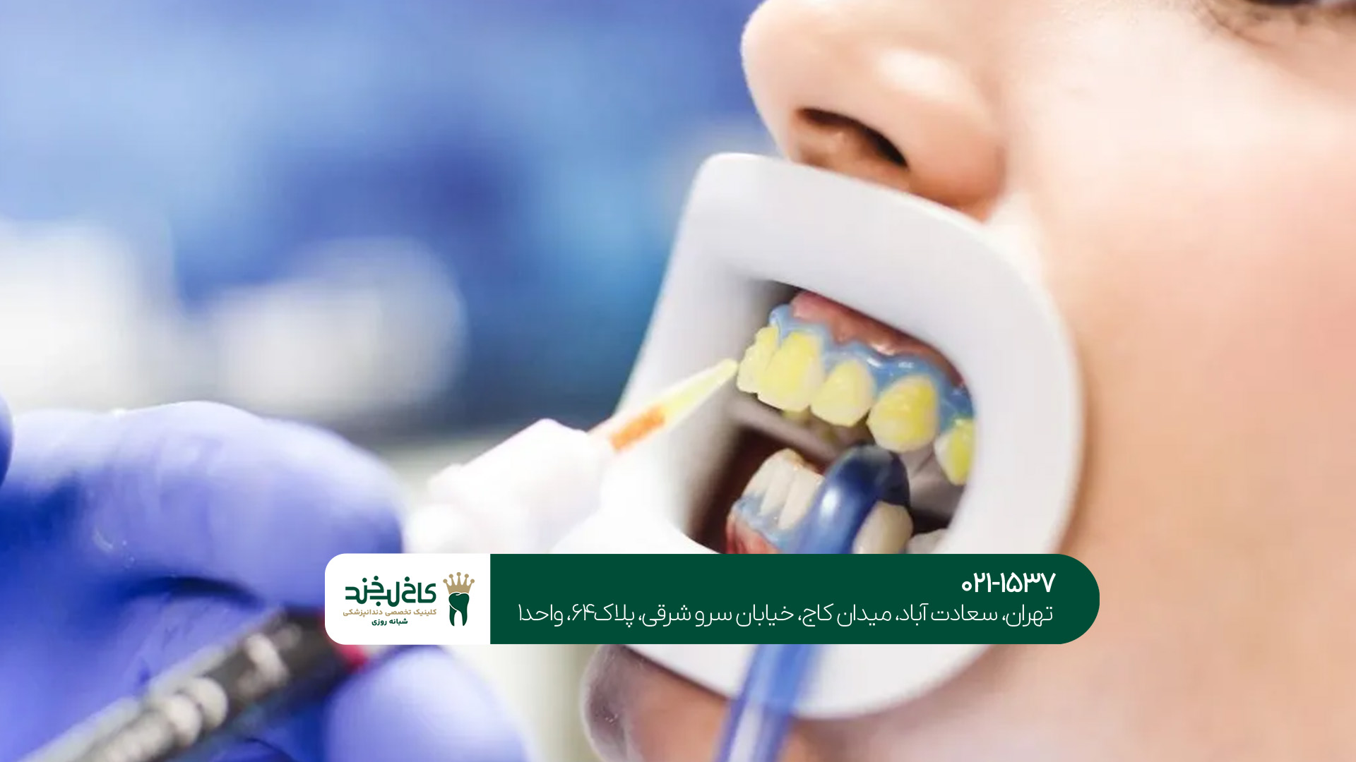 دندانپزشکی تهران