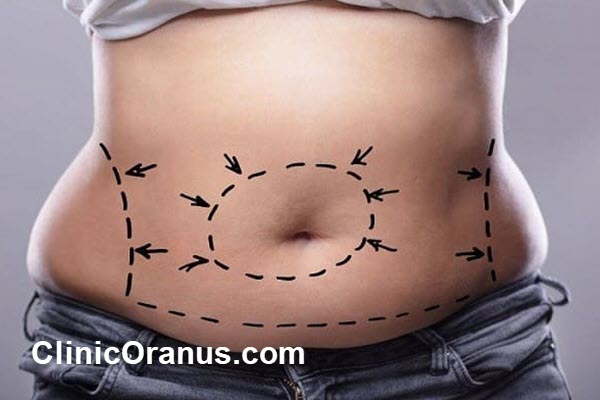 بهترین کلینیک پیکرتراشی در تهران | کلینیک اورانوس