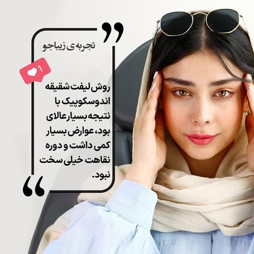 تجربه لیفت شقیقه اندوسکوپیک