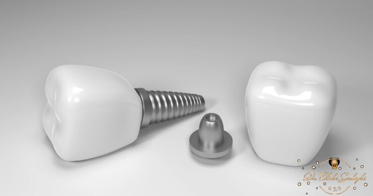 ایمپلنت پانچی