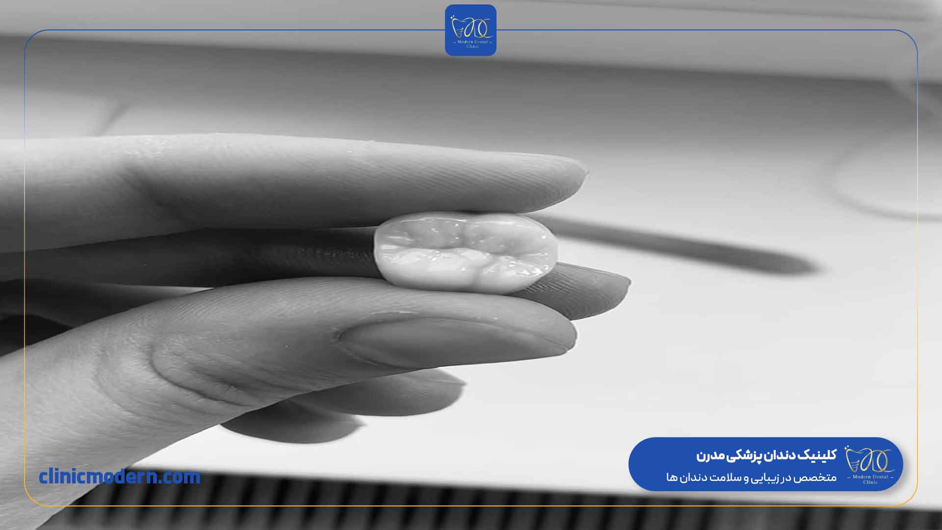 کلینیک مدرن مرکز تخصصی انجام اینلی و آنلی دندان در سراسر ایران