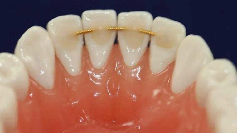 ارتودنسی ارزان در کرج