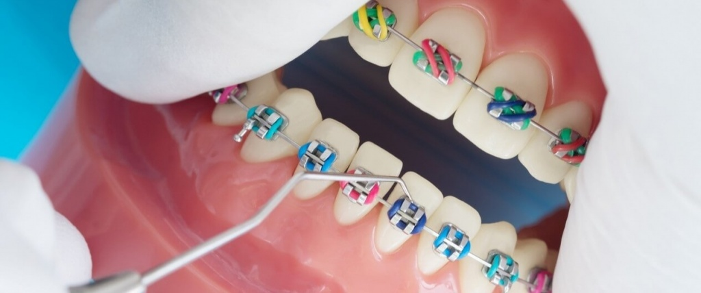 ارتودنسی ارزان در کرج