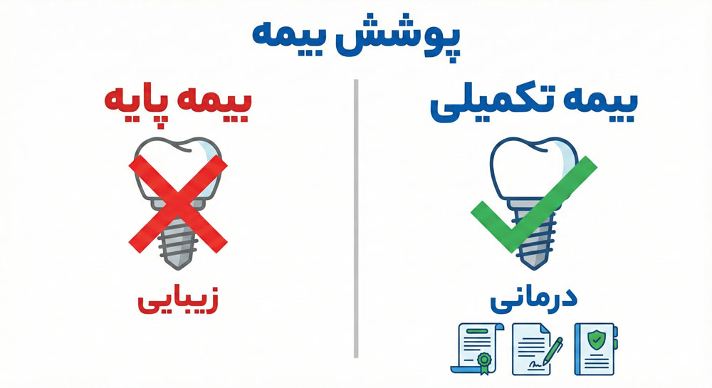 پوشش بیمه ایمپلنت بیمه تکمیلی و پایه