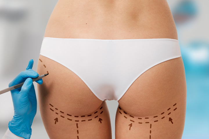 بهترین روش بزرگ کردن و فرم دهی باسن