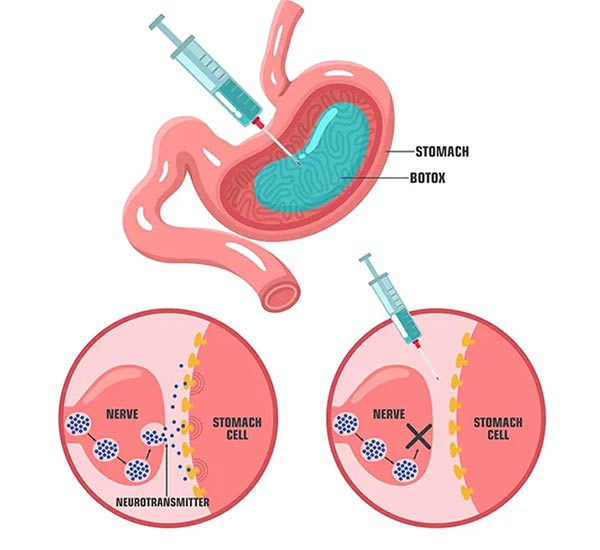 فراتر از محدودیت‌های بشقاب؛ مسیر هوشمندانه برای مدیریت وزن