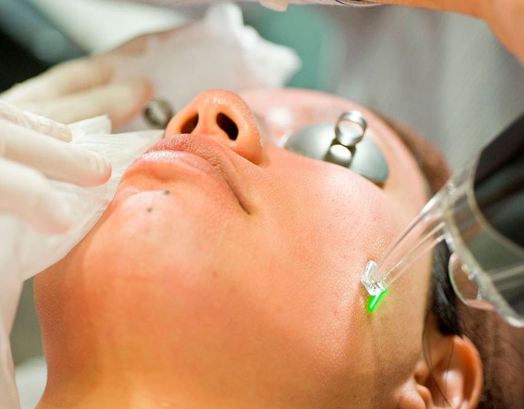 2 روش کارآمد برای کاهش منافذ باز پوست