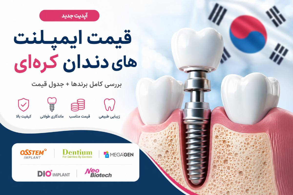 هزینه ایمپلنت‌ دندان کره‌ای + جدول انواع برندها (آپدیت 1405)