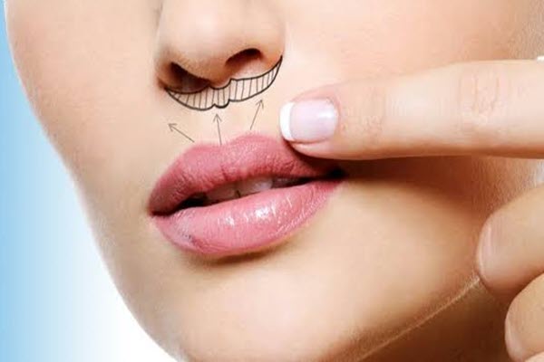 گام های رسیدن به چهره ایده آل در کلینیک بنیتا
