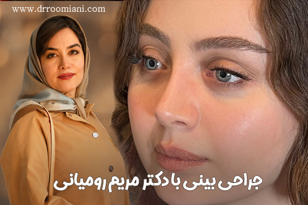 جراح بینی تهران دکتر مریم رومیانی