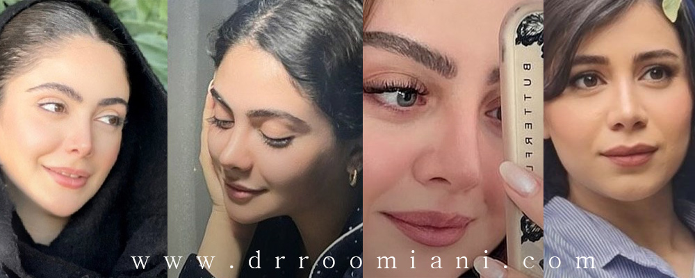 نمونه کارهای عمل بینی دکتر مریم رومیانی