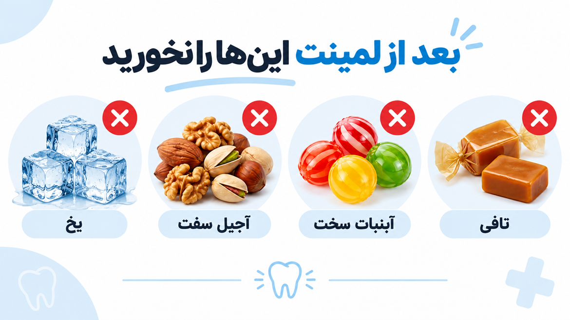 بعد از لمینت دندان چه غذاهایی نخوریم؟