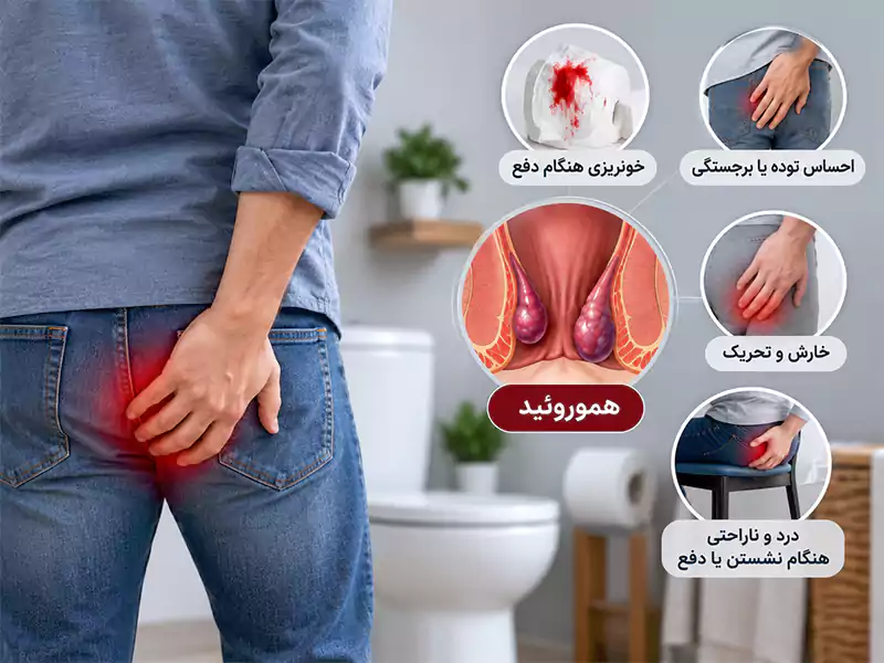 علائم هموروئید و زمان مراجعه به پزشک