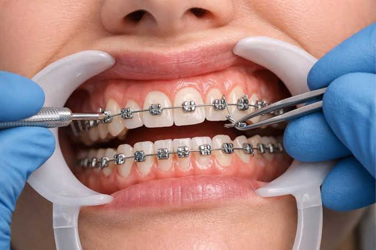 اصلاح ناهنجاری‌های فک و دندان با روش‌های نوین ارتودنسی در کلینیک دندانپزشکی مهر پارسه