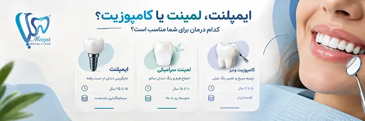 ایمپلنت، لمینت یا کامپوزیت؟
