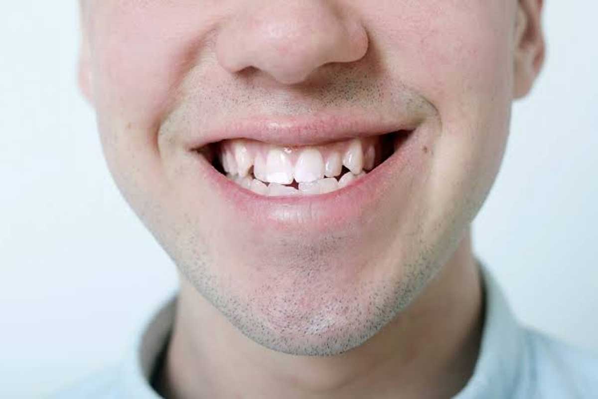ناهنجاری‌های فک و دندان