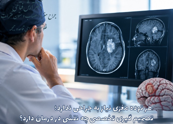 هر توده مغزی نیاز به جراحی ندارد؛ تصمیم گیری تخصصی چه نقشی در درمان دارد؟